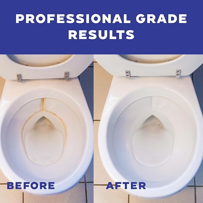 Don Aslett's Complete Toilet Cleaning Set | Includes 32 oz Toilet Cleaner, Convenient Cleaning Caddy, Johnny Mop Toilet Brush, and Pumice Stone for Tough Stains