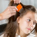 how-to-remove-lice-from-hair-permanently